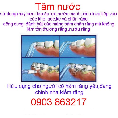 Máy Tăm Nước Dành Cho Trẻ Con Waterpik Water Flosser For Kids WP-260