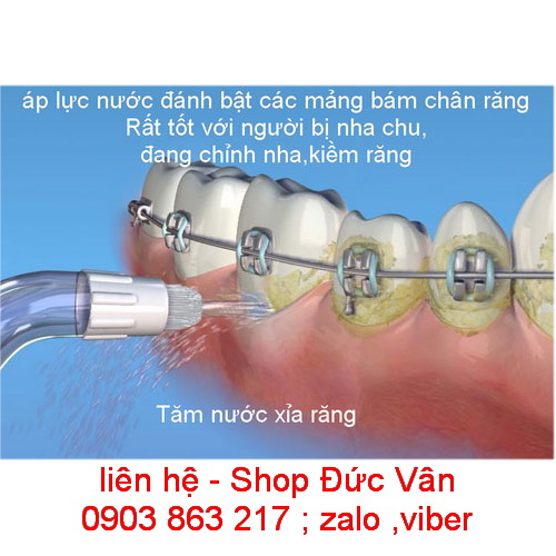 Máy Tăm Nước Dành Cho Trẻ Con Waterpik Water Flosser For Kids WP-260
