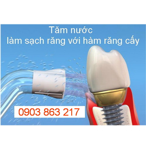 Máy Tăm Nước Dành Cho Trẻ Con Waterpik Water Flosser For Kids WP-260