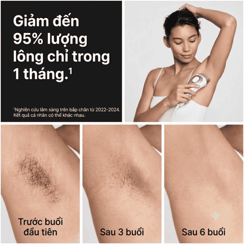 Máy Triệt Lông Cá Nhân Braun Skin i·expert IPL PL7243 - Công Nghệ Cảm Biến Tông Da, 3 Đầu Triệt
