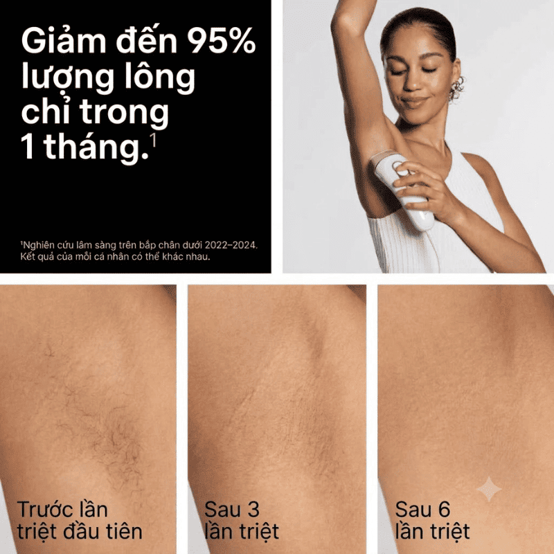 Máy Triệt Lông Cầm Tay Braun Silk-expert Pro 5 PL5137 - Triệt Lông Cá Nhân IPL Tại Nhà Chính Hãng