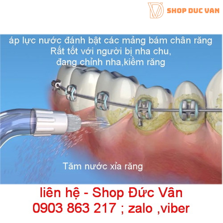 Máy tăm nước / xỉa răng nước Waterpik WP260w